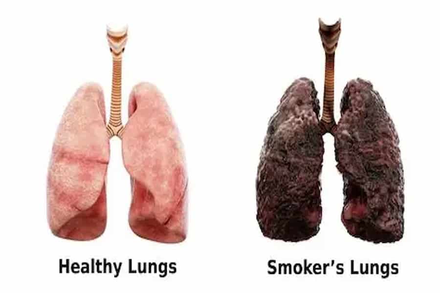 healthy lungs
